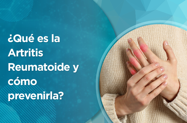 10 ARTICULO ARTRITIS REUMATOIDE.png
